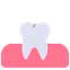 Veneers 2