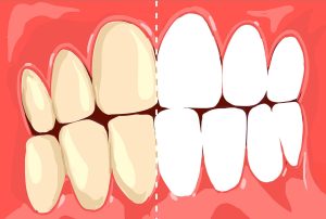 AdobeStock 232446202 scaled e1709025461149 300x202