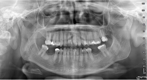 Renson Isabelle 1977 04 05 PAN47 1 1