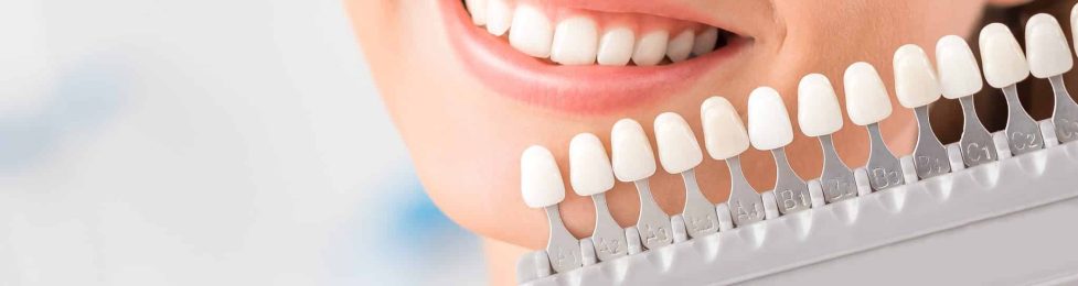 Magnifique sourire et dents blanches d'une jeune femme. Assortir les teintes des implants ou le blanchiment dentaire.